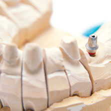 Model of dental implant